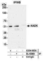 NADK Antibody in Immunoprecipitation (IP)