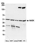 NADK Polyclonal Antibody