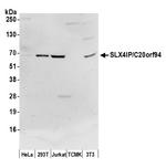 SLX4IP/C20orf94 Antibody in Western Blot (WB)