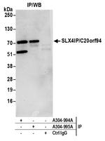 SLX4IP/C20orf94 Polyclonal Antibody