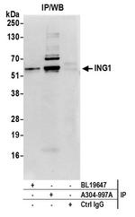 ING1 Antibody in Immunoprecipitation (IP)