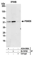 PSMD5/26S Proteasome Subunit S5B Antibody in Immunoprecipitation (IP)