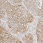 Ribosomal Protein S3A/RPS3A Polyclonal Antibody