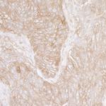 Ribosomal Protein S3A/RPS3A Antibody in Immunohistochemistry (Paraffin) (IHC (P))