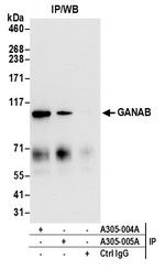 GANAB/Glucosidase II Subunit alpha Antibody in Immunoprecipitation (IP)