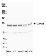 GANAB/Glucosidase II Subunit alpha Polyclonal Antibody