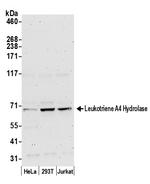 Leukotriene A4 Hydrolase/LTA4H Polyclonal Antibody