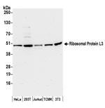 Ribosomal Protein L3/RPL3 Polyclonal Antibody