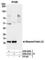 Ribosomal Protein L23/RPL23 Antibody in Immunoprecipitation (IP)