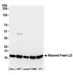 Ribosomal Protein L23/RPL23 Polyclonal Antibody