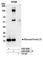 Ribosomal Protein L23/RPL23 Antibody in Immunoprecipitation (IP)