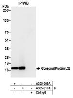 Ribosomal Protein L23/RPL23 Antibody in Immunoprecipitation (IP)
