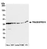 TRA2B/SFRS10 Polyclonal Antibody