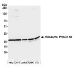 Ribosomal Protein S8/RPS8 Polyclonal Antibody