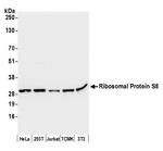 Ribosomal Protein S8/RPS8 Polyclonal Antibody
