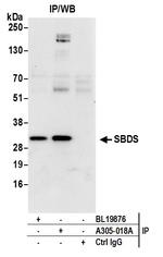 Shwachman-Bodian-Diamond Syndrome/SBDS Antibody in Immunoprecipitation (IP)
