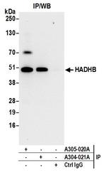 HADHB Antibody in Immunoprecipitation (IP)