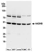 HADHB Polyclonal Antibody