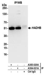 HADHB Antibody in Immunoprecipitation (IP)