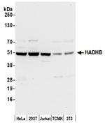 HADHB Polyclonal Antibody