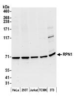 RPN1/Ribophorin I Polyclonal Antibody