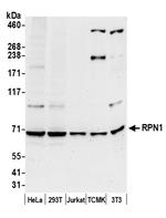 RPN1/Ribophorin I Polyclonal Antibody
