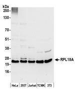 RPL18A/Ribosomal Protein L18a Polyclonal Antibody