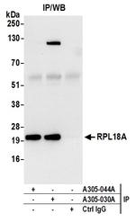 RPL18A/Ribosomal Protein L18a Antibody in Immunoprecipitation (IP)