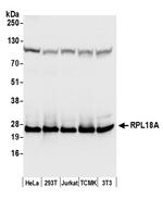 RPL18A/Ribosomal Protein L18a Polyclonal Antibody