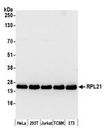 RPL21/Ribosomal Protein L21 Antibody in Western Blot (WB)