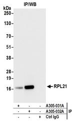 RPL21/Ribosomal Protein L21 Antibody in Immunoprecipitation (IP)