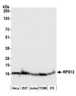 RPS12/Ribosomal Protein S12 Polyclonal Antibody