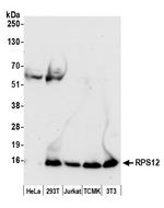 RPS12/Ribosomal Protein S12 Antibody in Western Blot (WB)