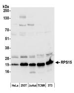 RPS15/Ribosomal Protein S15 Polyclonal Antibody