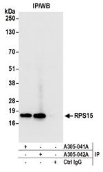 RPS15/Ribosomal Protein S15 Antibody in Immunoprecipitation (IP)