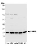 RPS15/Ribosomal Protein S15 Polyclonal Antibody