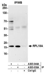 RPL18A/Ribosomal Protein L18a Antibody in Immunoprecipitation (IP)