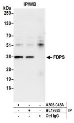 FDPS Antibody in Immunoprecipitation (IP)