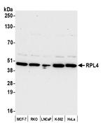 RPL4/Ribosomal Protein L4 Polyclonal Antibody