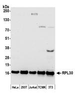 RPL30/Ribosomal Protein L30 Polyclonal Antibody