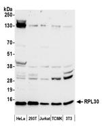RPL30/Ribosomal Protein L30 Polyclonal Antibody