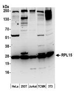 RPL15/Ribosomal Protein L15 Polyclonal Antibody