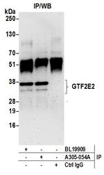 GTF2E2/TF2E2/TFIIE-beta Antibody in Immunoprecipitation (IP)