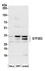 GTF2E2/TF2E2/TFIIE-beta Polyclonal Antibody