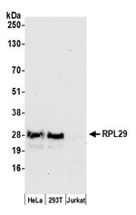 RPL29/Ribosomal Protein L29 Polyclonal Antibody