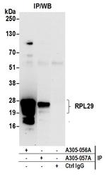 RPL29/Ribosomal Protein L29 Antibody in Immunoprecipitation (IP)