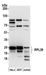 RPL29/Ribosomal Protein L29 Polyclonal Antibody