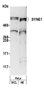 SYNE1/CPG2/Nesprin 1 Polyclonal Antibody