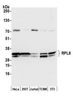 RPL8/Ribosomal Protein L8 Polyclonal Antibody