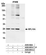 RPL10A/Ribosomal Protein L10a Antibody in Immunoprecipitation (IP)